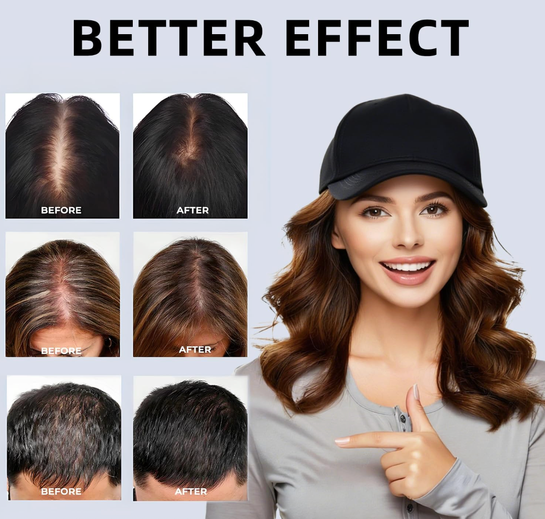 Dermatologist Recommended*** Laser Hair Growth Cap - Red & Blue Light Therapy for Hair Regrowth, Full Scalp Coverage Treatment for Men & Women